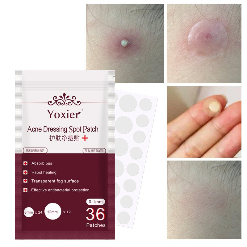 Hydrocolloid Acne Pimple Patches - Invisible Blemish Spot Stickers for Face (36 Count) - Image 10